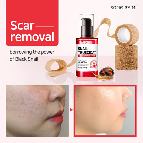 Snail Truecica Miracle Repair Serum - Focallure™ Arabia