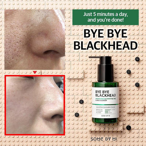 Bye Bye Blackhead 30 Days Miracle Green Tea Tox Bubble Cleanser - Focallure™ Arabia