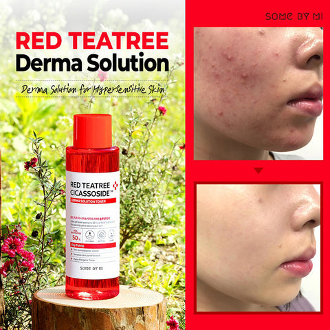 Red Teatree Cicassoside Final Solution Toner - Focallure™ Arabia