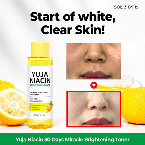 Yuja Niacin 30 Days Miracle Brightening Toner - Focallure™ Arabia