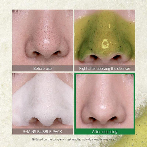 Bye Bye Blackhead 30 Days Miracle Green Tea Tox Bubble Cleanser - Focallure™ Arabia