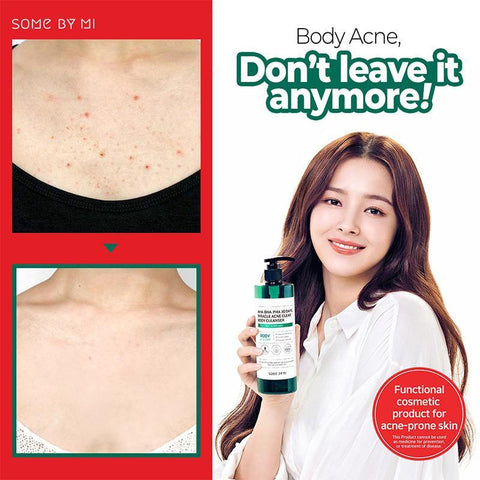 AHA-BHA-PHA 30 Days Miracle Acne Clear Body Cleanser 400g - Focallure™ Arabia