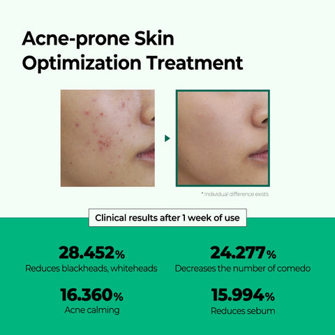 Miracle AC Clear Spot Treatment