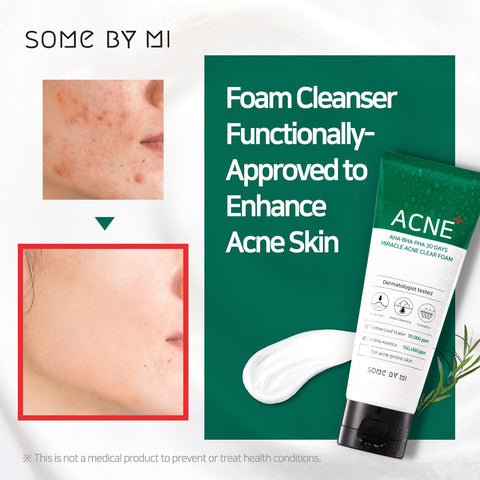 AHA-BHA-PHA 30 Days Miracle Acne Clear Foam
