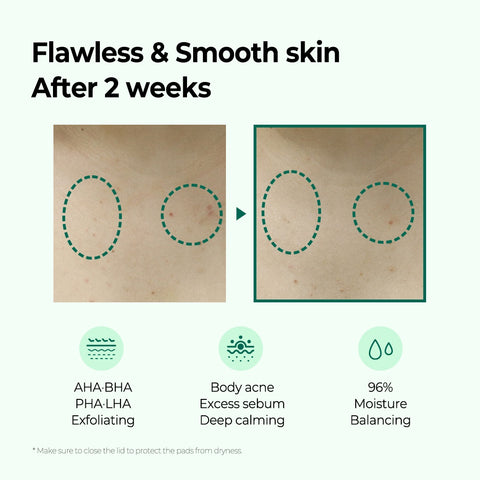 AHA-BHA-PHA Miracle Calming Body Lotion (200ML)